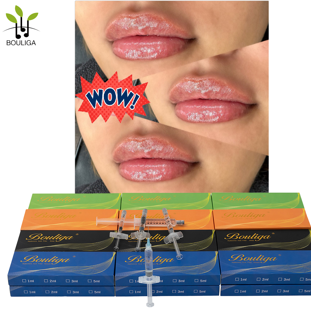 Bouliga Dermal filler 2ml te gebruiken voor lippen en rimpels